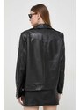 Usnjena biker jakna Elisabetta Franchi ženska, črna barva